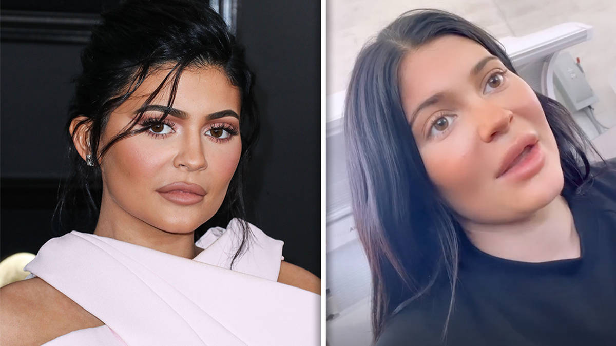 Kylie Jenner Skincare Routine: What Moisturizer Does Kylie Jenner Use?